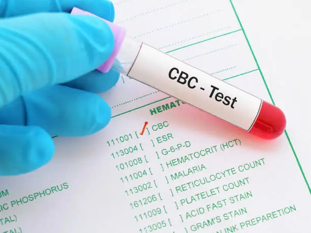 CBC Test at Home Dubai – Life Aid